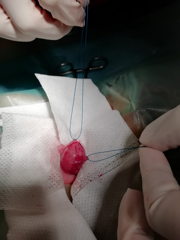 Tratamiento quirúrgico: cistotomía y extracción de urolitos en la vejiga