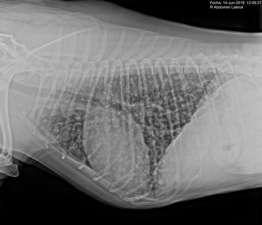 pruebas diagnósticas radiografía