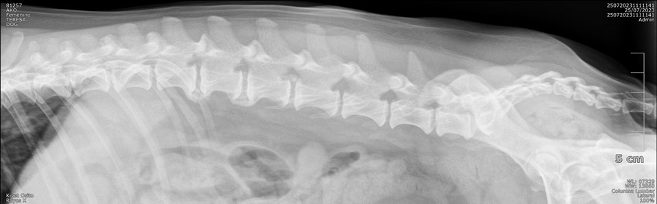 Extrusión discal derecha Kivet Osito