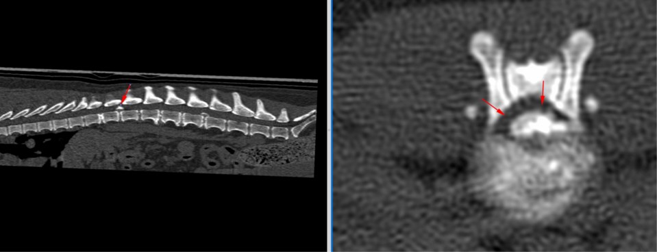 Extrusión discal izquierda Kivet Osito