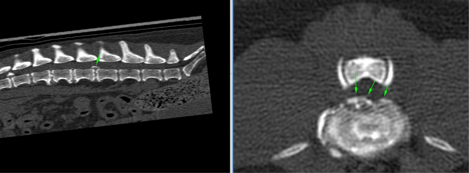 Extrusión discal derecha Ako Kivet Osito